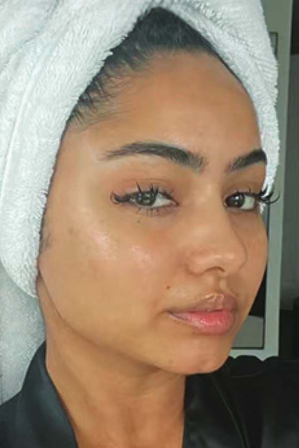 Customer skin after 6 weeks