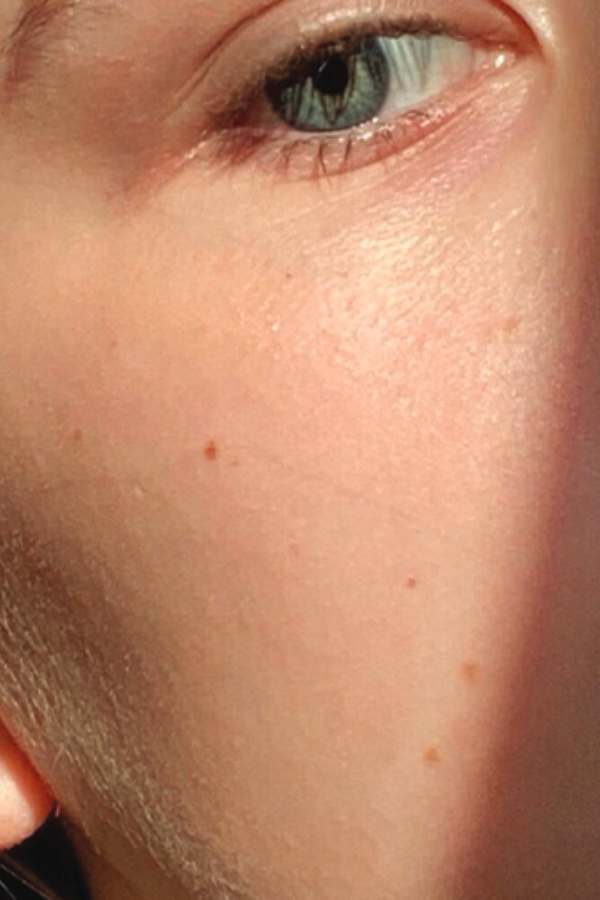 Customer skin after 8 weeks